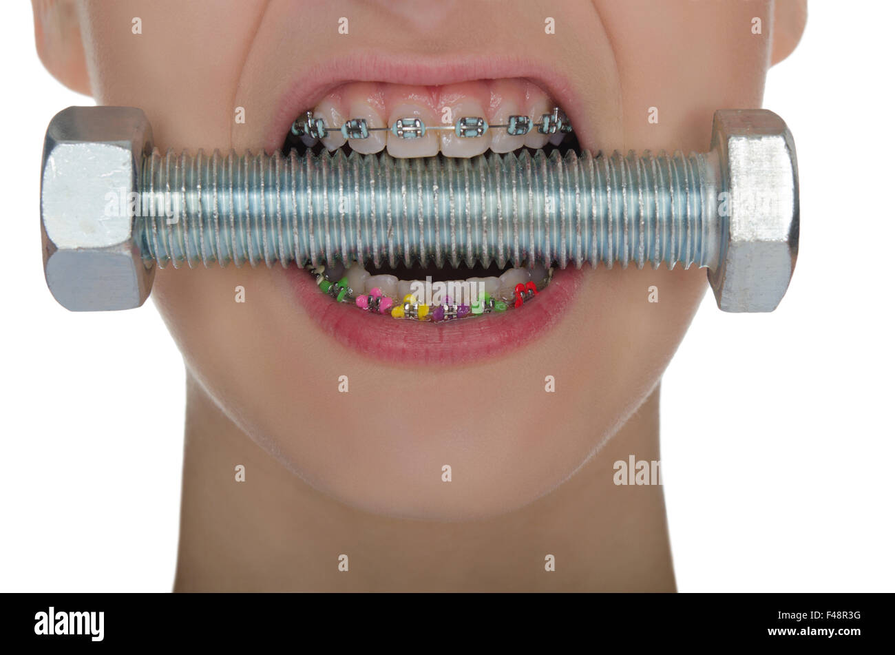 Dents avec accolades métalliques comprimé visser Banque D'Images