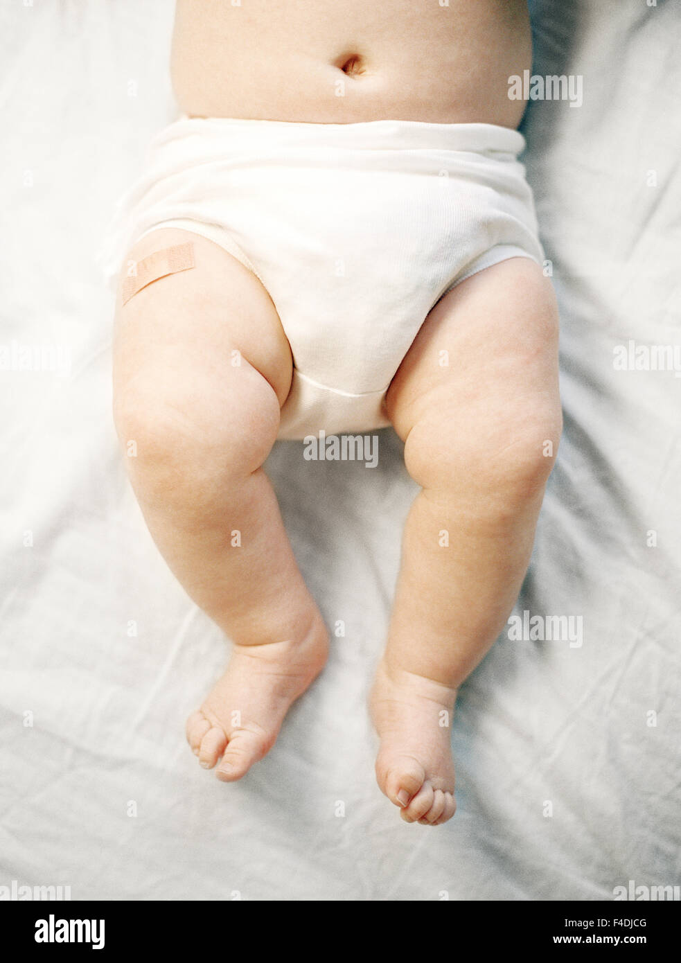 Un Emplatre Sur Une Jambe Sur Un Bebe Photo Stock Alamy