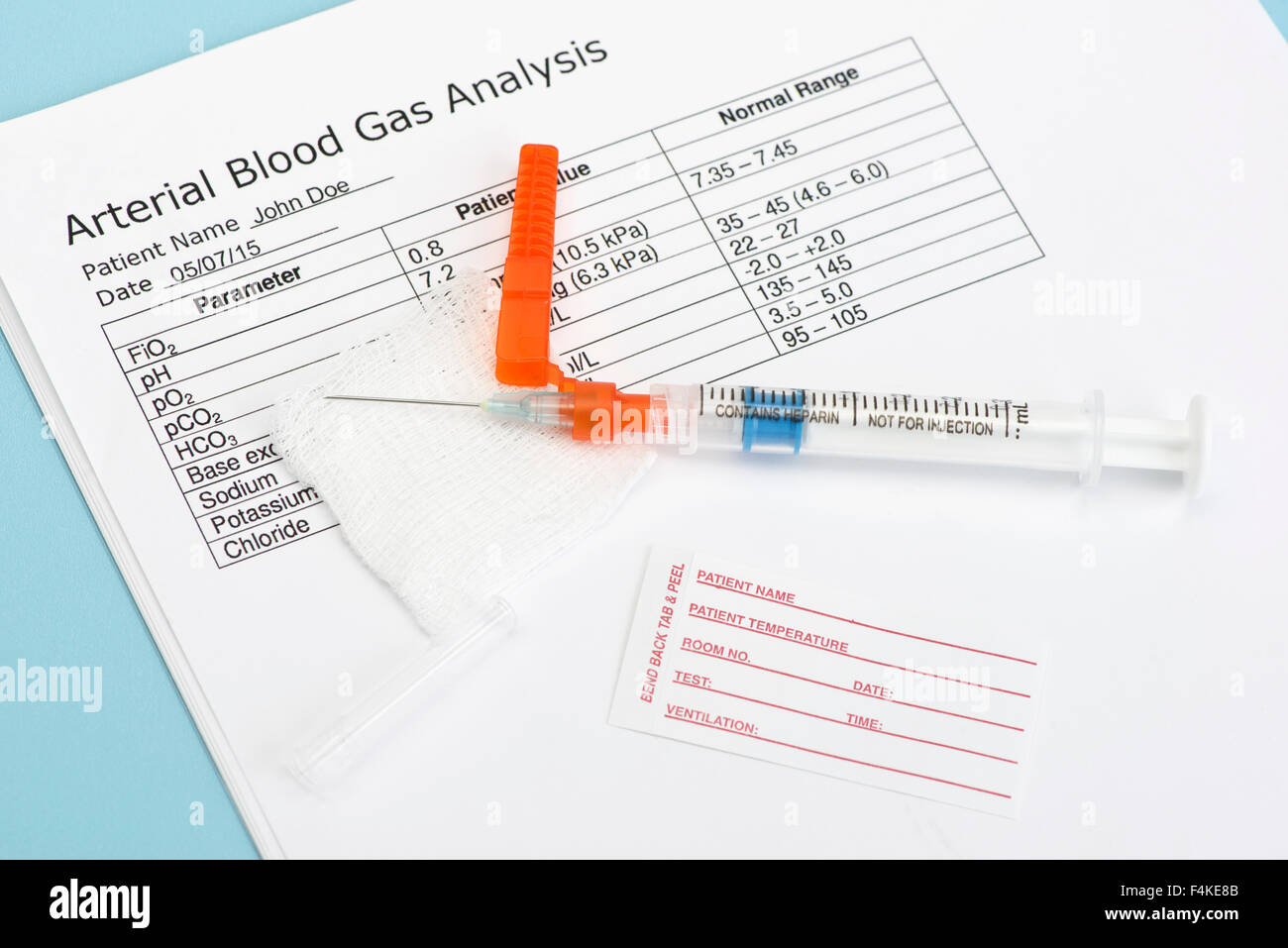 Échantillon de gaz du sang artériel seringue d'étiquette de nom et de rapport de laboratoire. L'héparine est un médicament de marque non-nom. Banque D'Images
