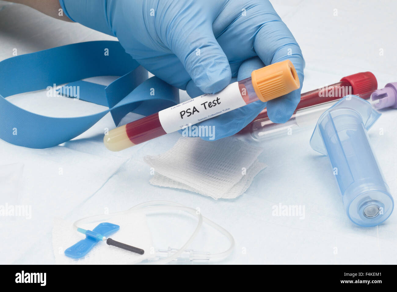 L'antigène prostatique spécifique sanguin PSA tube de collecte d'échantillon de culture Banque D'Images