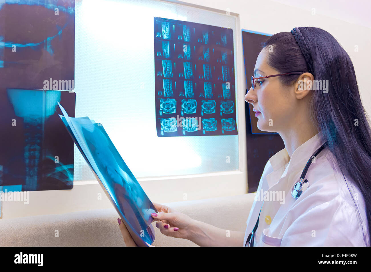 Un médecin examine les rayons X. Banque D'Images