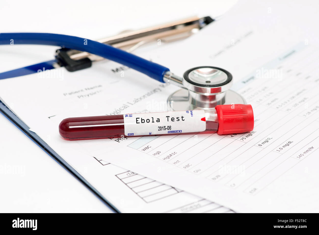 Le tube de prélèvement sanguin avec étiquette test Ebola sur dossier médical. Banque D'Images