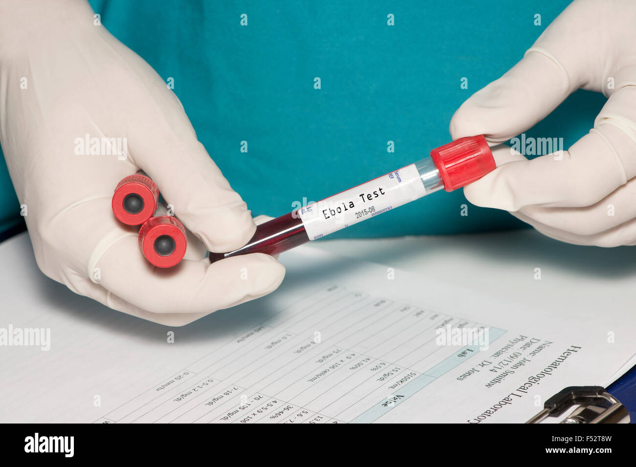 Le tube de prélèvement sanguin avec étiquette test Ebola détenues par technicien. Label créé par le photographe. Banque D'Images