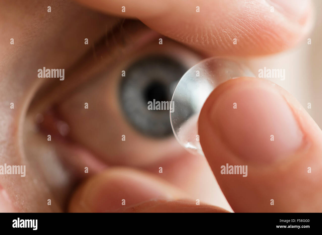 Un homme est l'insertion d'une lentille de contact sur l'œil gauche. Banque D'Images