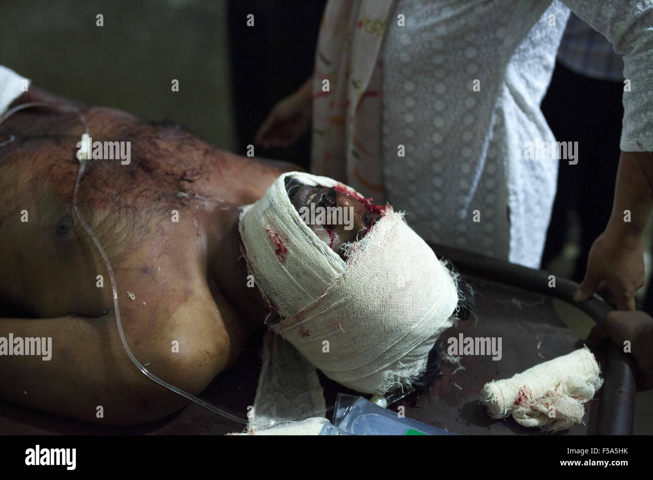 Dhaka, Bangladesh. 31 octobre, 2015. L'équipe médicale : Ahmed Jashim tenant à l'intérieur de Lafé-baleng ICU Dhaka Medical College Hospital à Dhaka le 31 octobre, 2015.Deux blogueurs et écrivains - Ahmedur Lafé-baleng Rashid, Sudeep Kumar Barman et Tarek Rahim, ont été piratés dans le domaine Lalmatia le dimanche après-midi. Lafé-baleng Ahmed Rashid est un éditeur, Shuddhaswar prokashani de propriétaire. Il a publié plusieurs livres de tué blogger Avijit Roy. Autour de 3:50h, ils ont été emmenés à Dhaka Medical College Hospital. Tarique Lafé-baleng et ont été prises pour l'exploitation du théâtre. Credit : ZUMA Press, Inc./Alamy Live News Banque D'Images