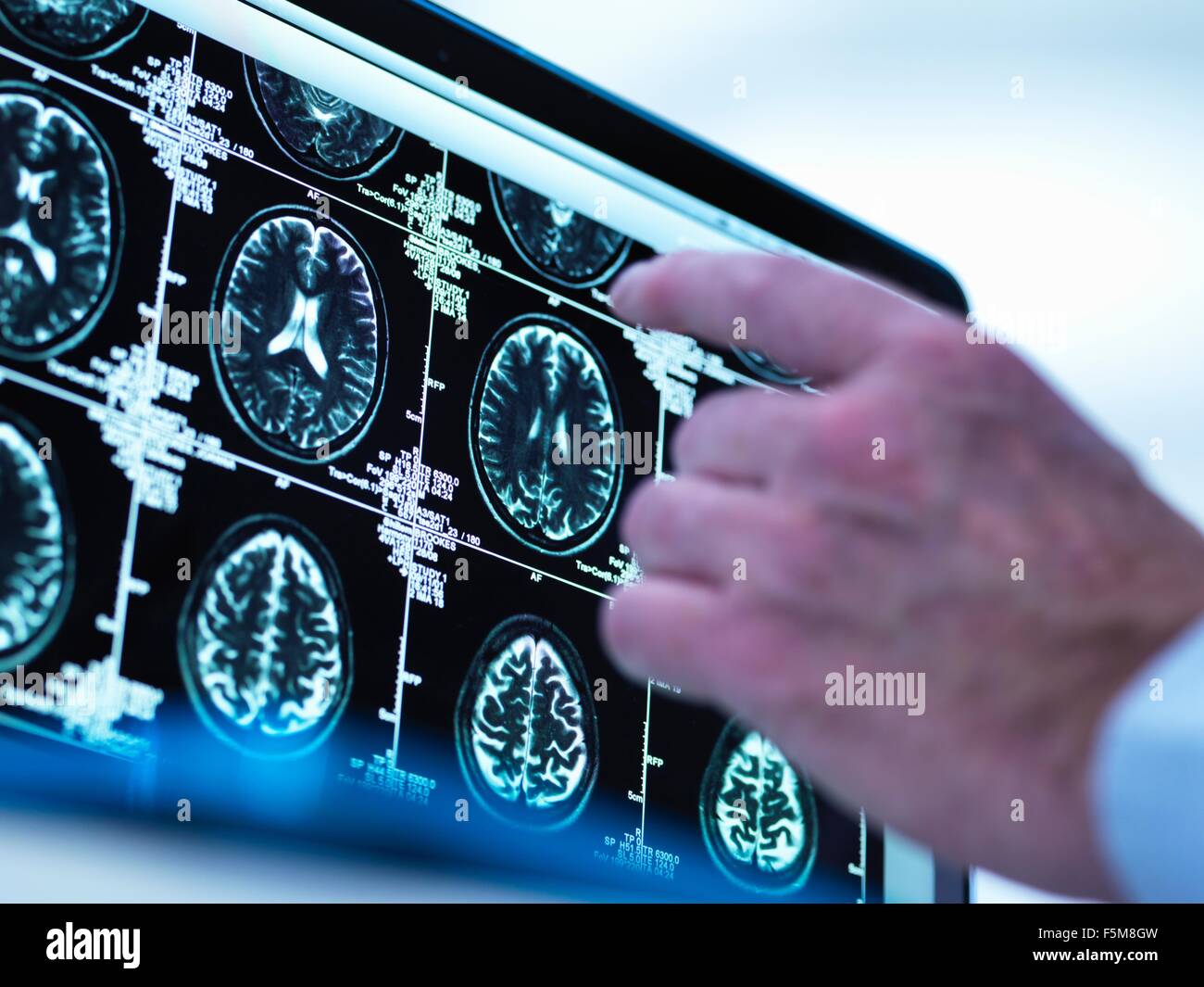 Médecin l'affichage d'une série d'IRM (imagerie par résonance magnétique) du cerveau sur un écran Banque D'Images