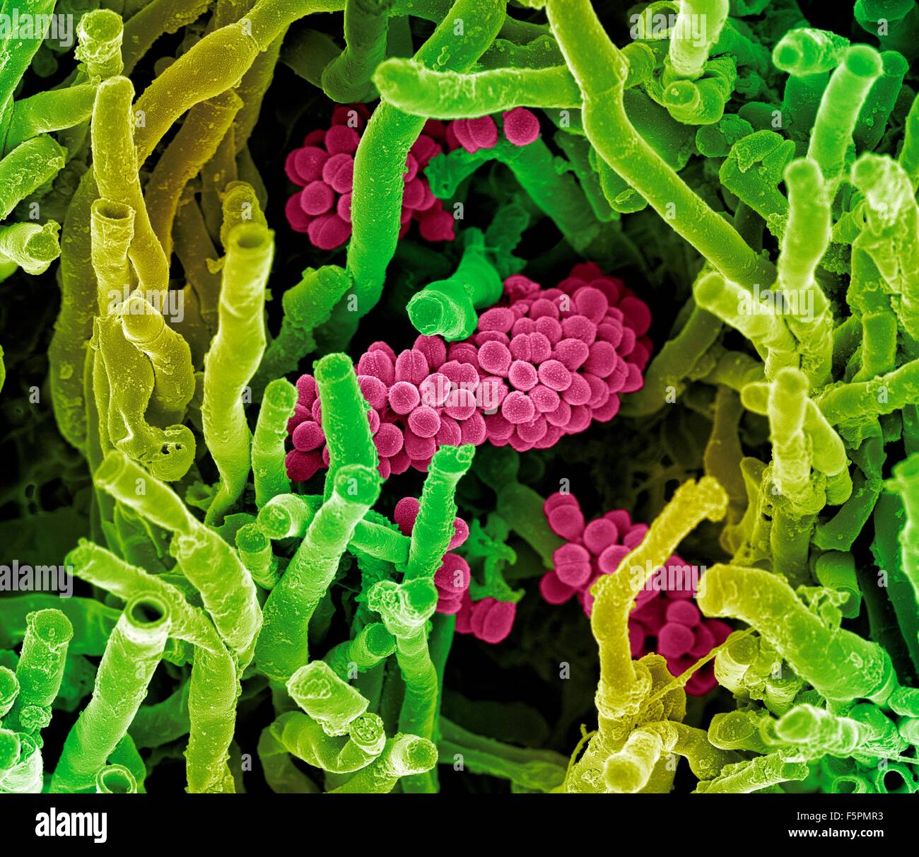 Les bactéries streptomyces coelicoflavus. Couleur de l'analyse des électrons Microphotographie (SEM) de la bactérie Streptomyces coelicoflavus Banque D'Images