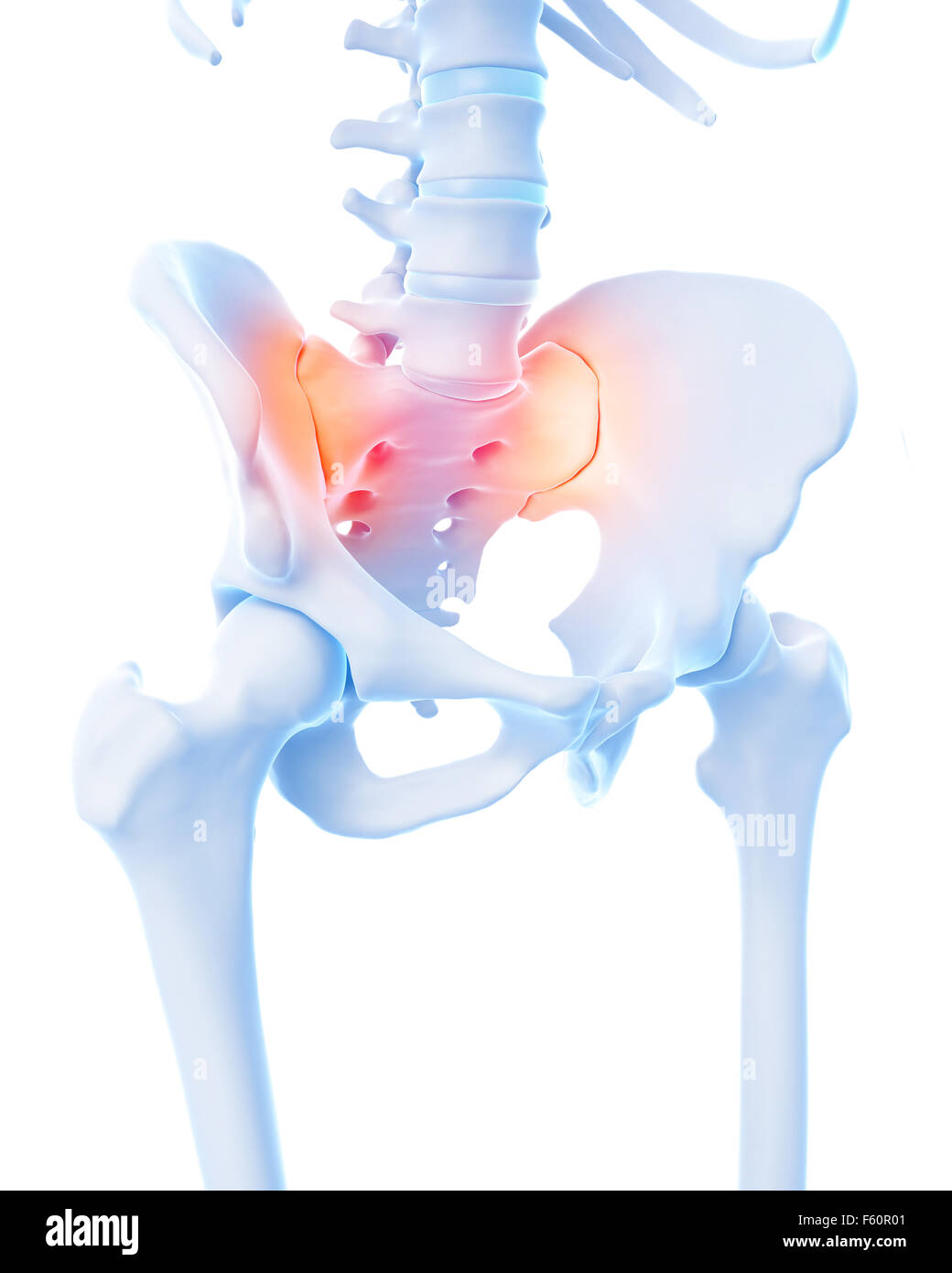 Medical 3d illustration d'un conjoint sacrum douloureux Banque D'Images