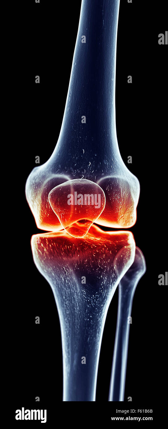 L'arthrose du genou l'anatomie des os du squelette de la jambe Banque D'Images
