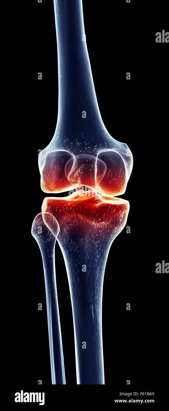 L'arthrose du genou l'anatomie des os du squelette de la jambe Banque D'Images