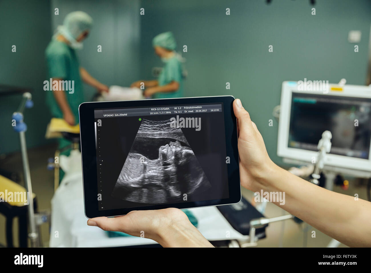 Mains tenant une tablette numérique montrant une image échographique d'un fœtus en salle d'opération Banque D'Images