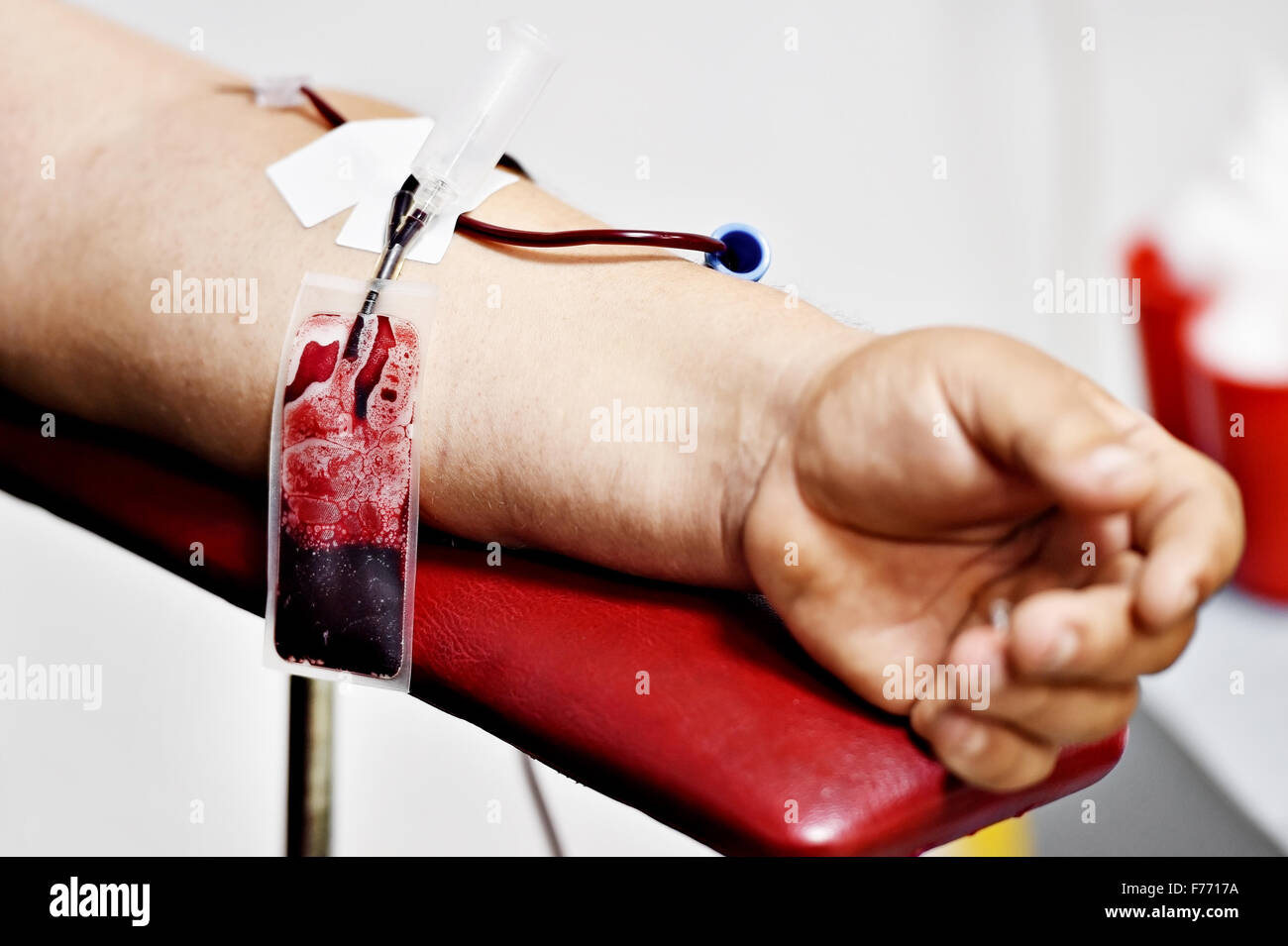 Détail de la main d'un don de sang et d'une poche de sang en plastique dans un hôpital Banque D'Images