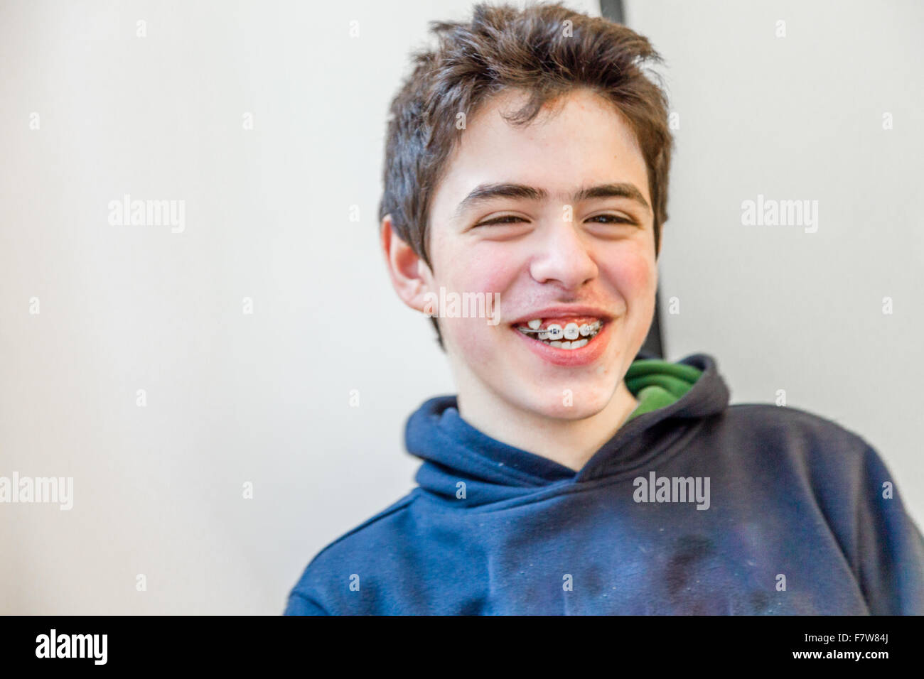 Young boy heureux et souriant à bretelles sur les dents Banque D'Images