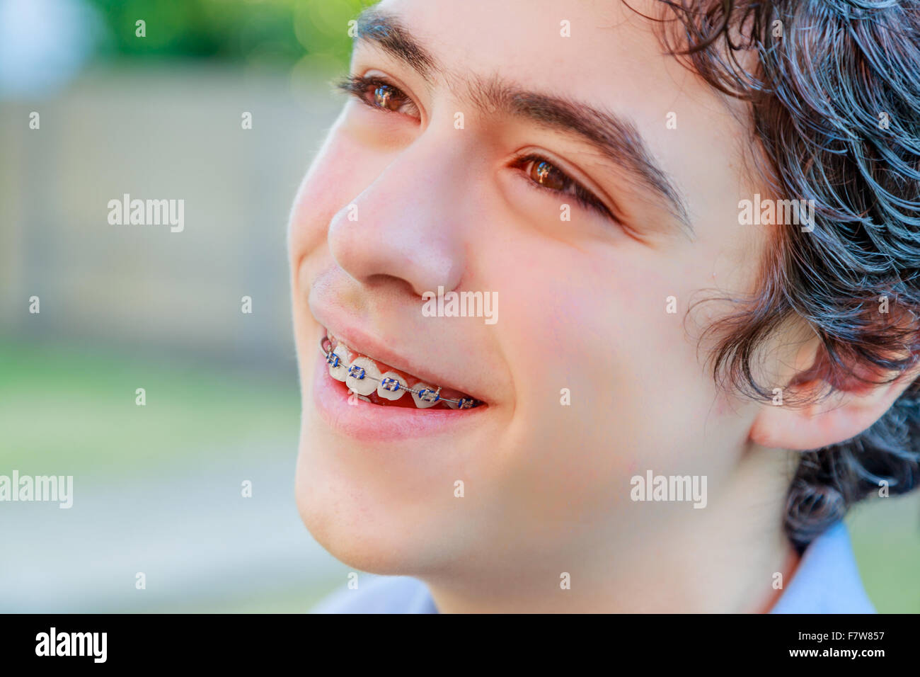 Close-up of Caucasian boy smiling et montrant un appareil orthodontique Banque D'Images