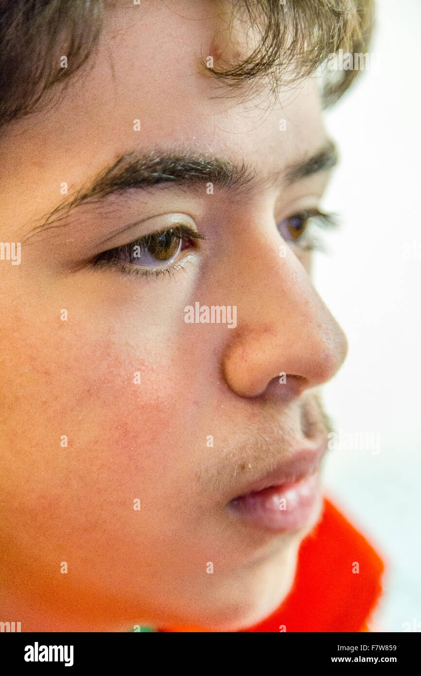 Close-up of a Teenage boy avec la pensée de peau d'acné Banque D'Images