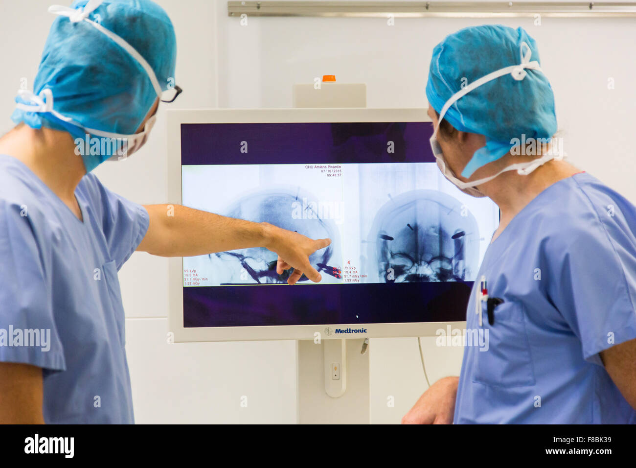 Traitement chirurgical de la maladie de Parkinson par stimulation cérébrale profonde avec Rosa ® robot, l'hôpital d'Amiens, France. Banque D'Images
