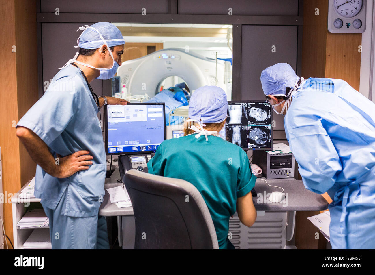 L'ablation par radiofréquence d'une tumeur au foie. Banque D'Images
