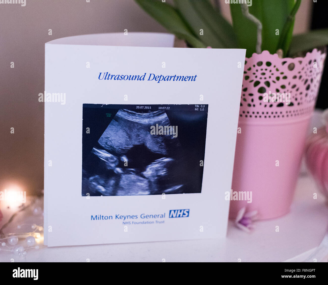 Photo d'échographie d'un bébé dans la maison d'une femme lors d'une naissance à domicile Banque D'Images