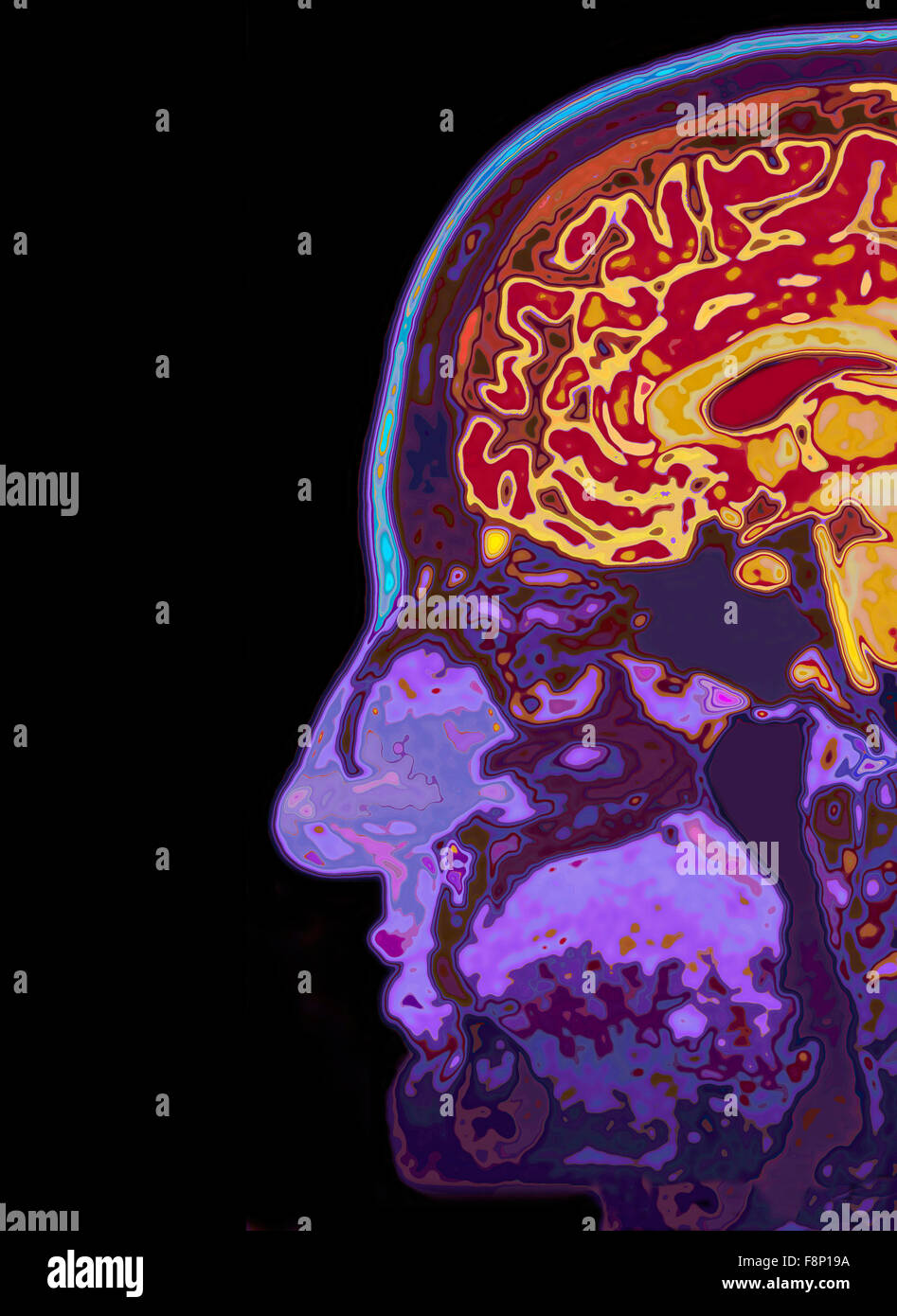 L'image IRM du cerveau montrant la tête Banque D'Images