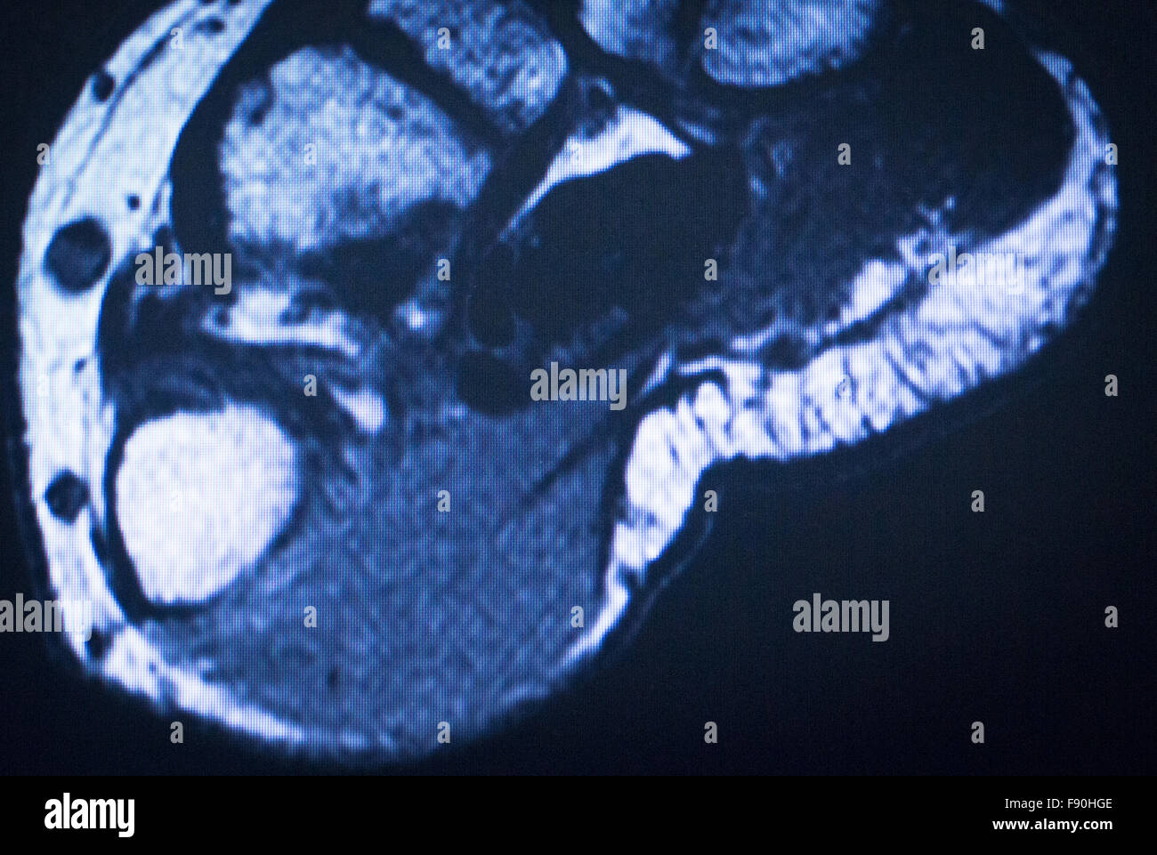 l-imagerie-par-r-sonance-magn-tique-irm-scan-test-m-dical-r-sultats-de