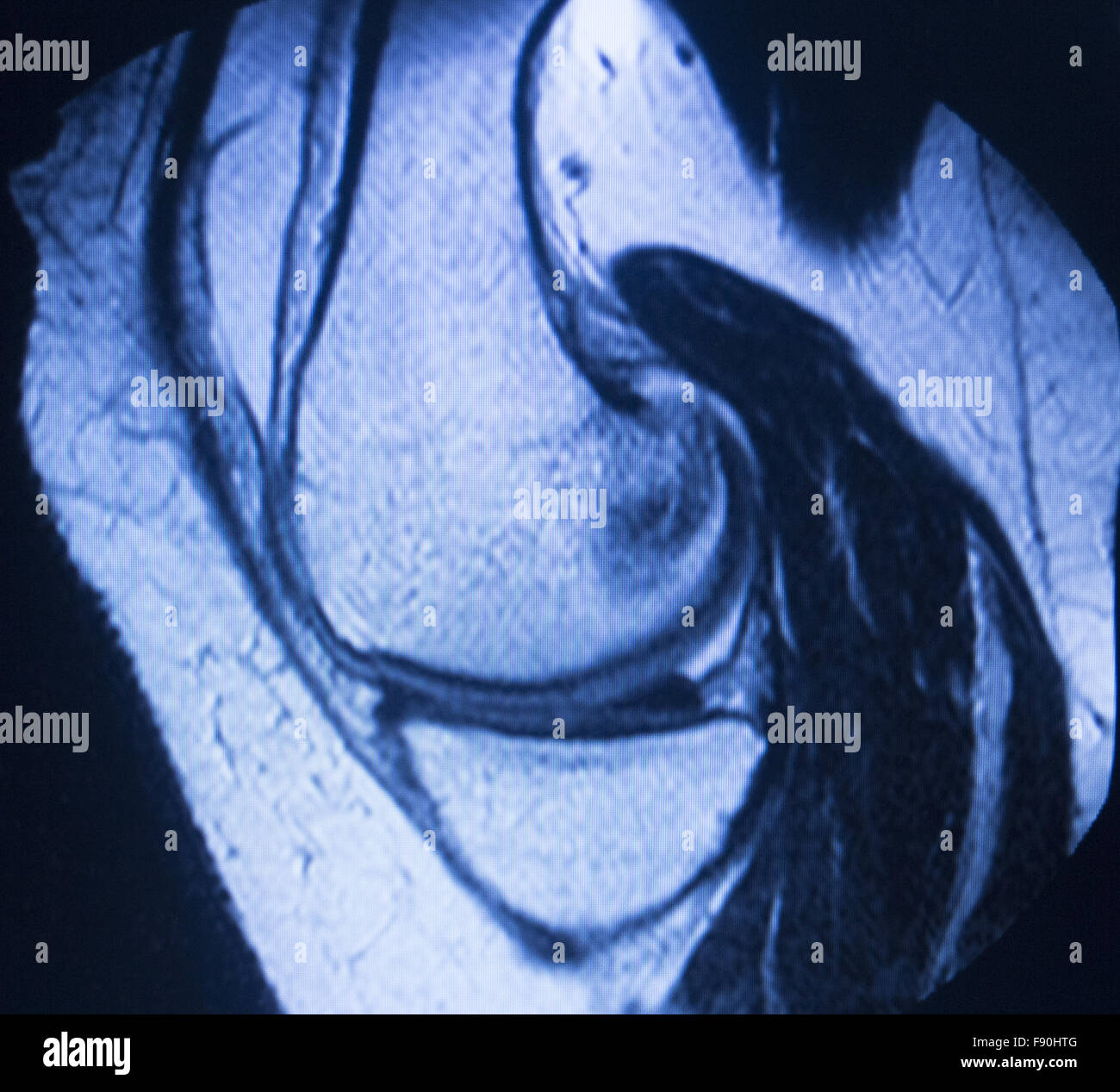 L'imagerie par résonance magnétique IRM scanner médical résultats de tests prouvant l