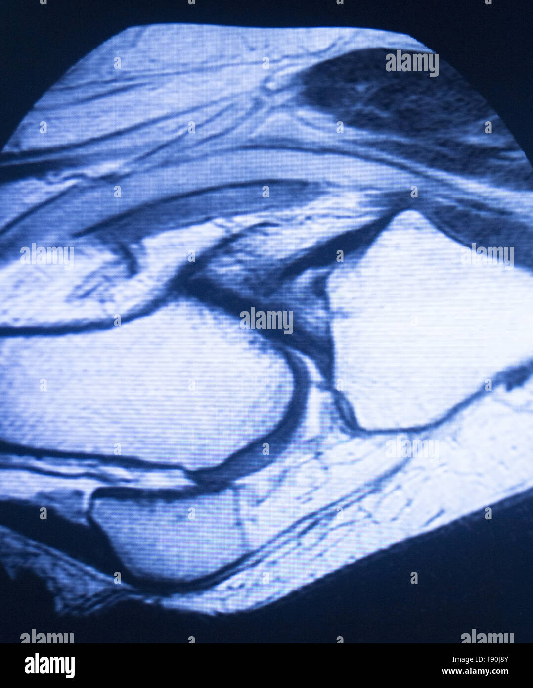 L'imagerie par résonance magnétique IRM scanner médical résultats de tests prouvant l