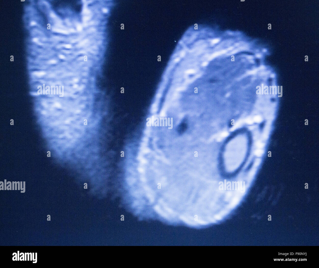 L'imagerie par résonance magnétique IRM scan test médical résultats de ...