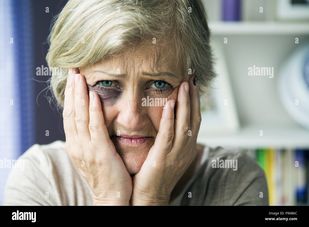 Senior woman with black eye est victime de violence domestique Banque D'Images