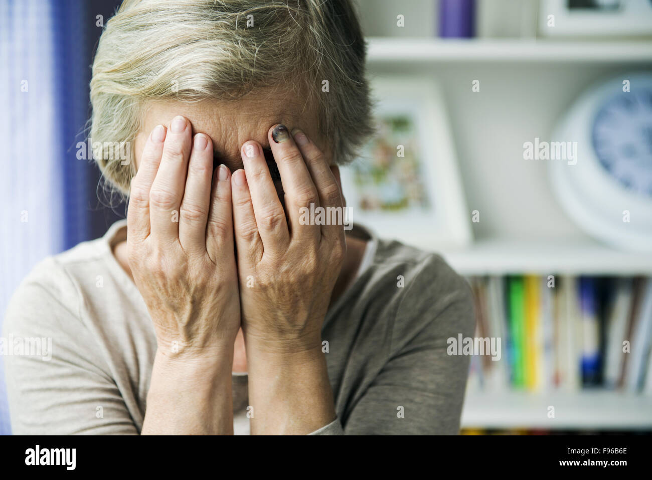 Senior woman with black eye est victime de violence domestique Banque D'Images