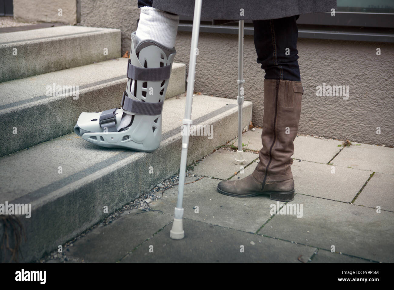De Gros Plan Femme Marche Avec Un Platre Et Des Bequilles Photo Stock Alamy