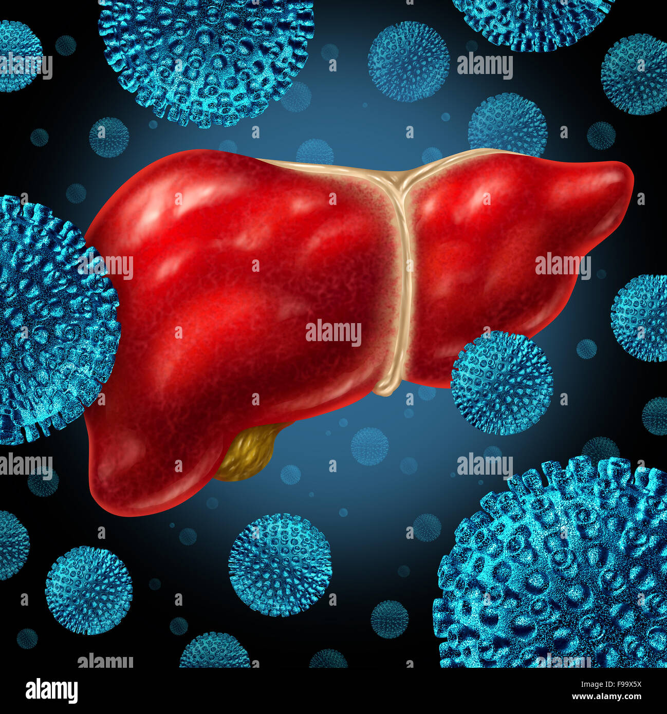 En tant qu'infection du foie le foie humain infecté par le virus de l'hépatite en tant que concept médical pour la maladie virale provoquant des symptômes de l'inflammation. Banque D'Images