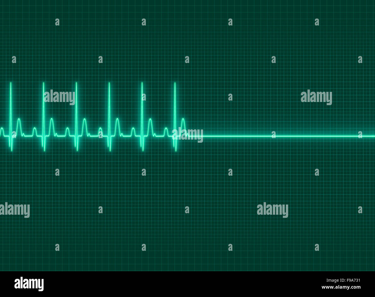 Une illustration de l'électrocardiographie exitus dark fond d'écran Banque D'Images