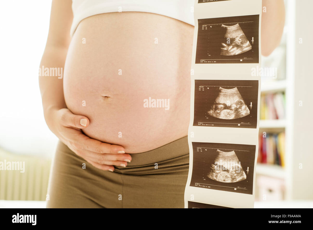 Méconnaissable pregnant woman holding ultrasound scan photo Banque D'Images