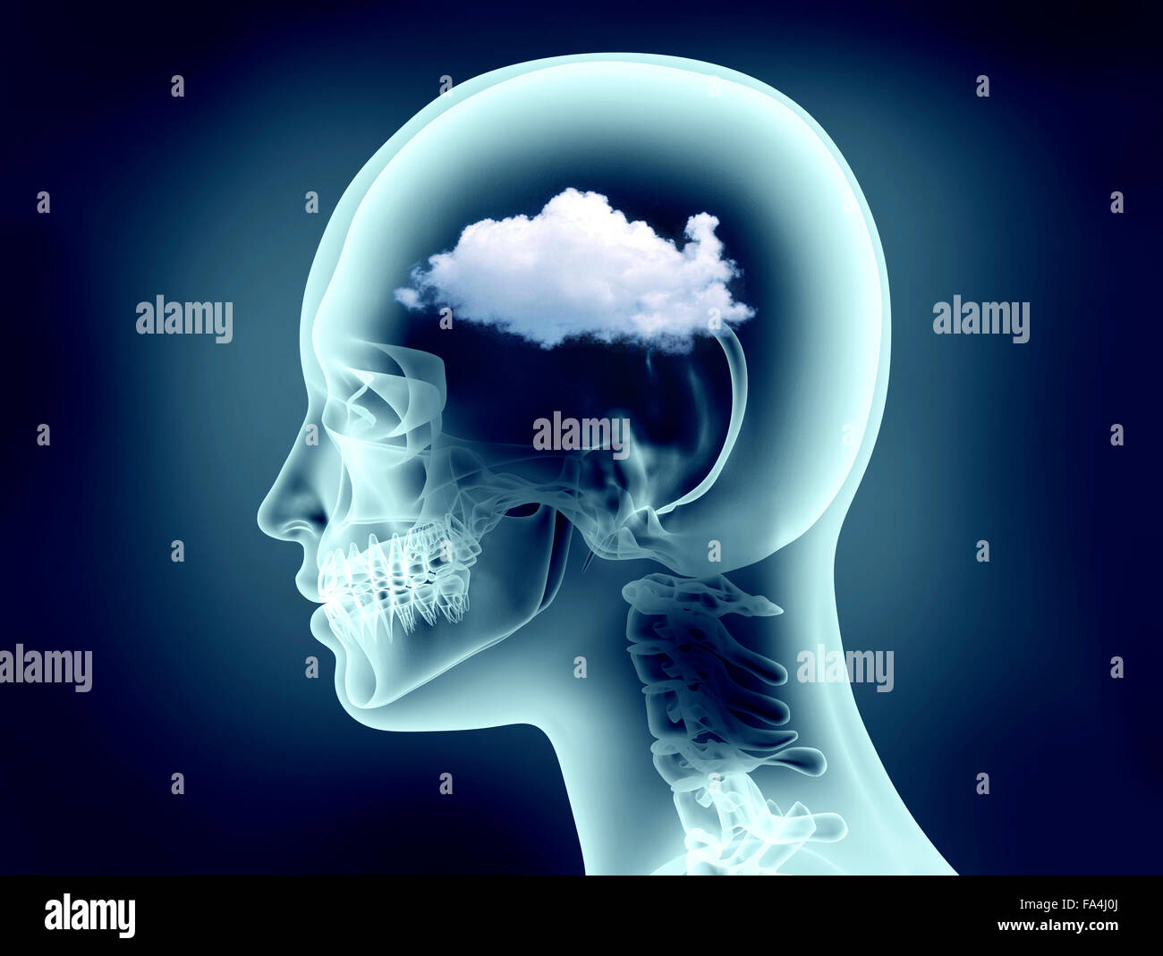 X-ray image de tête humaine avec le cloud Banque D'Images