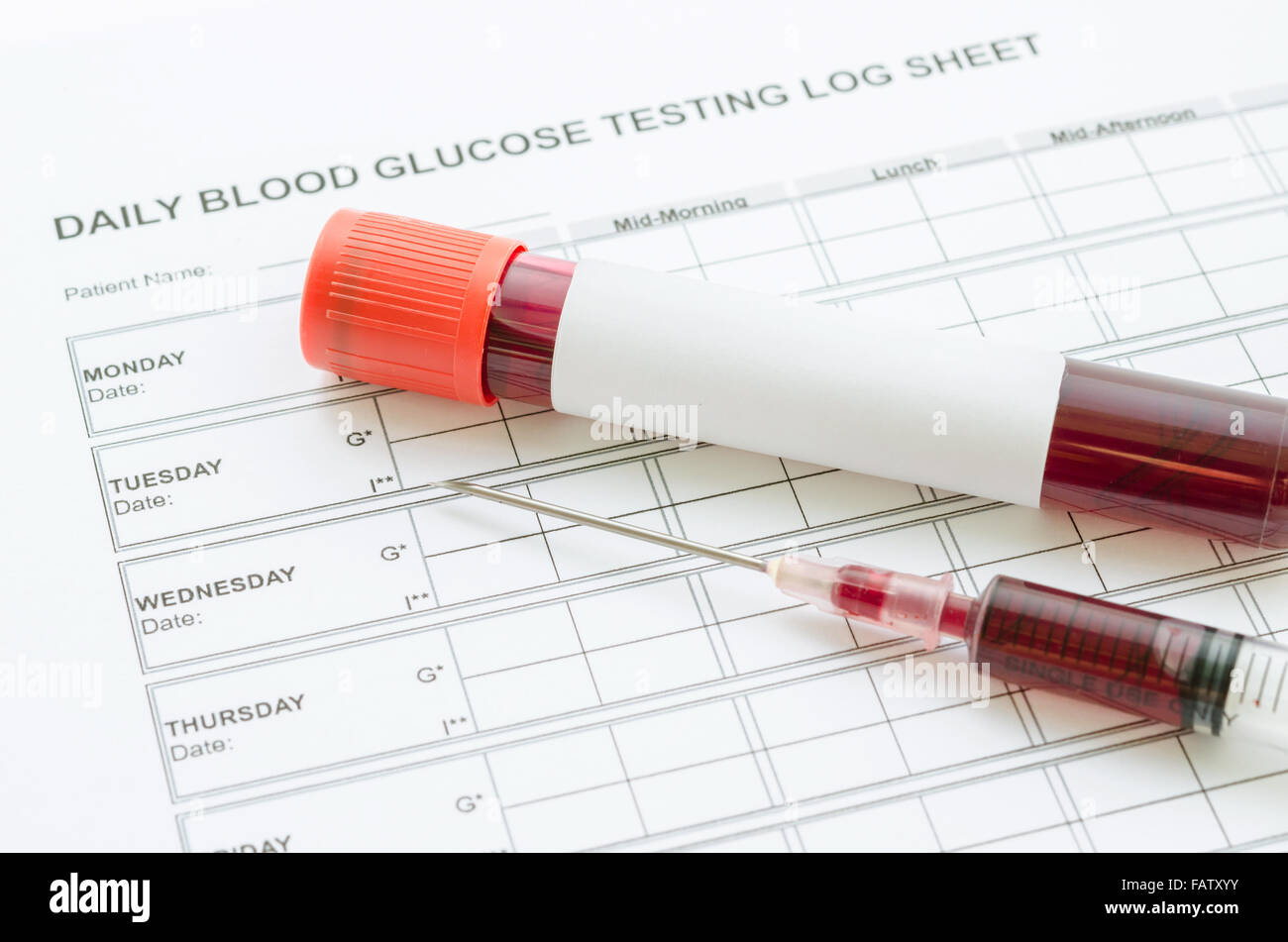 Tous les jours la glycémie et l'échantillon de sang en tube et seringue.  Concept de contrôle de sucre de sang Photo Stock - Alamy