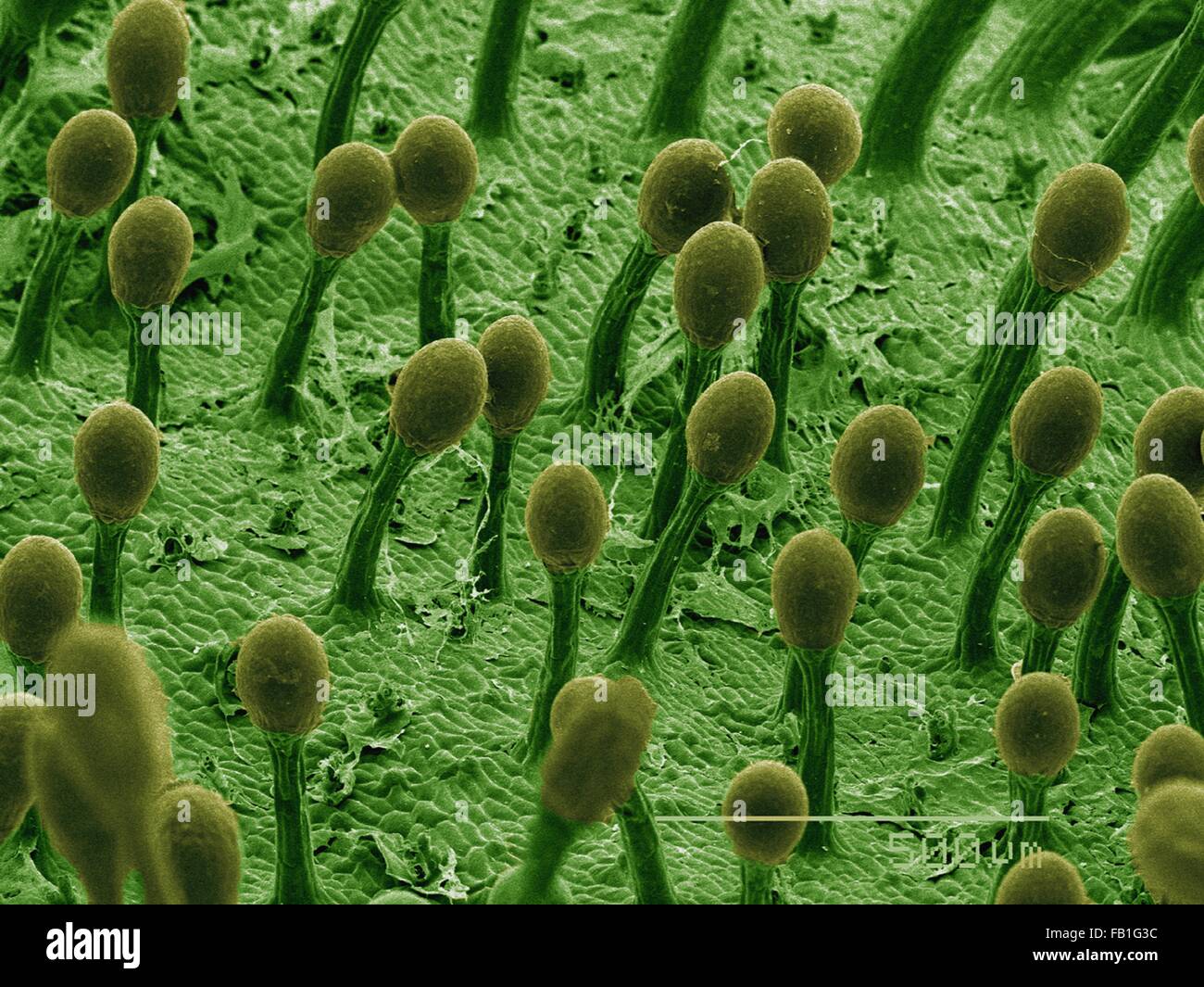 SEM de couleur de poils collants sur rossolis plantes carnivores Photo  Stock - Alamy