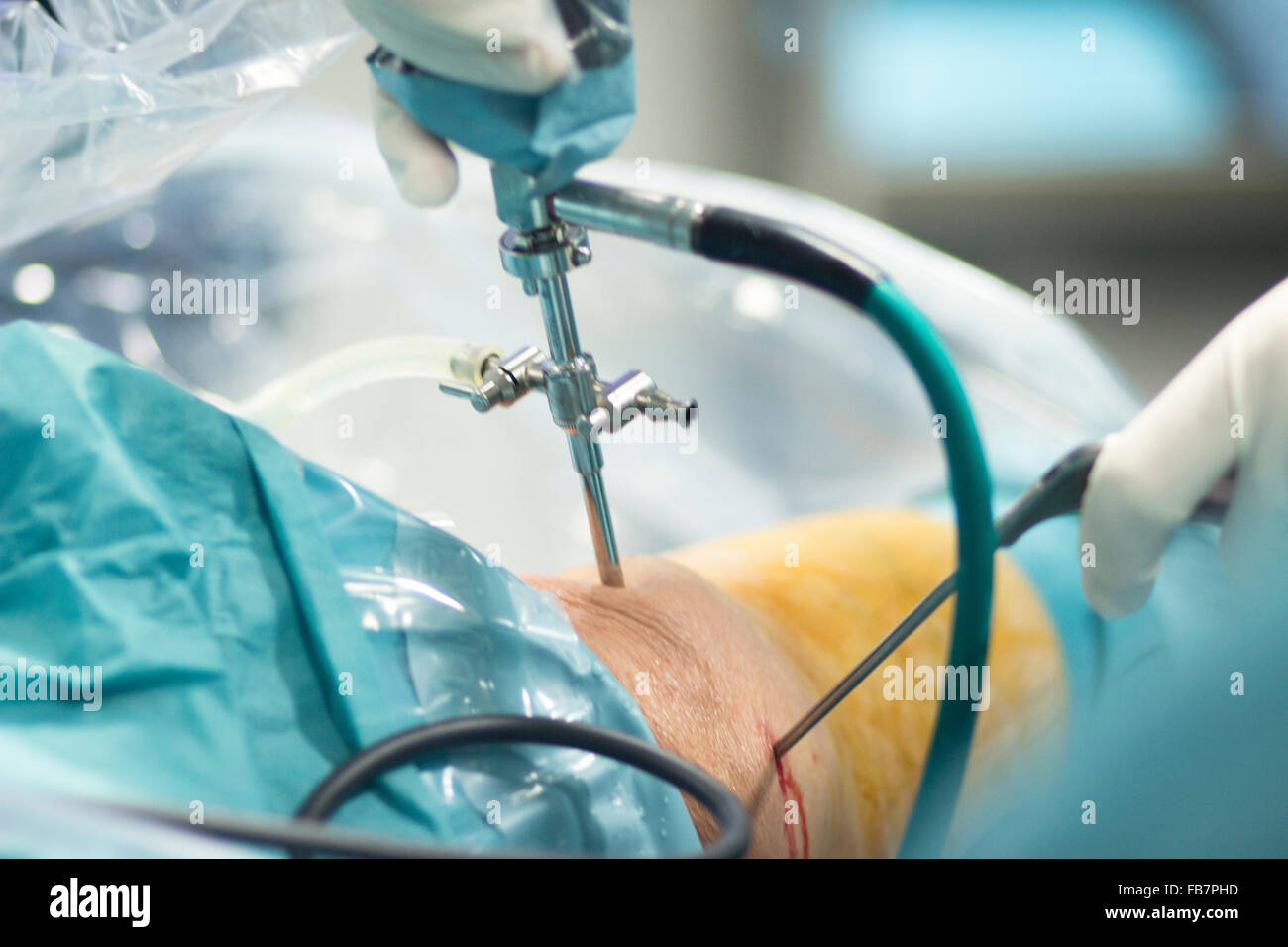 La chirurgie orthopédique de l