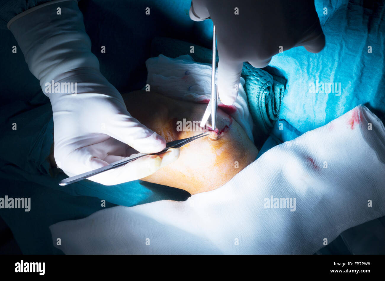 Le coude du bras de l'hôpital et de l'orthopédie traumatologie chirurgie  couture opération photo Photo Stock - Alamy