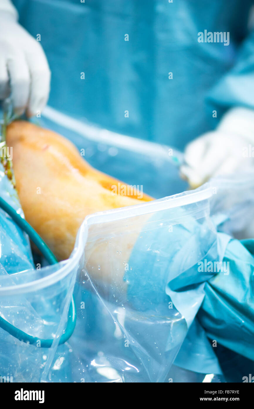 La chirurgie orthopédique de l