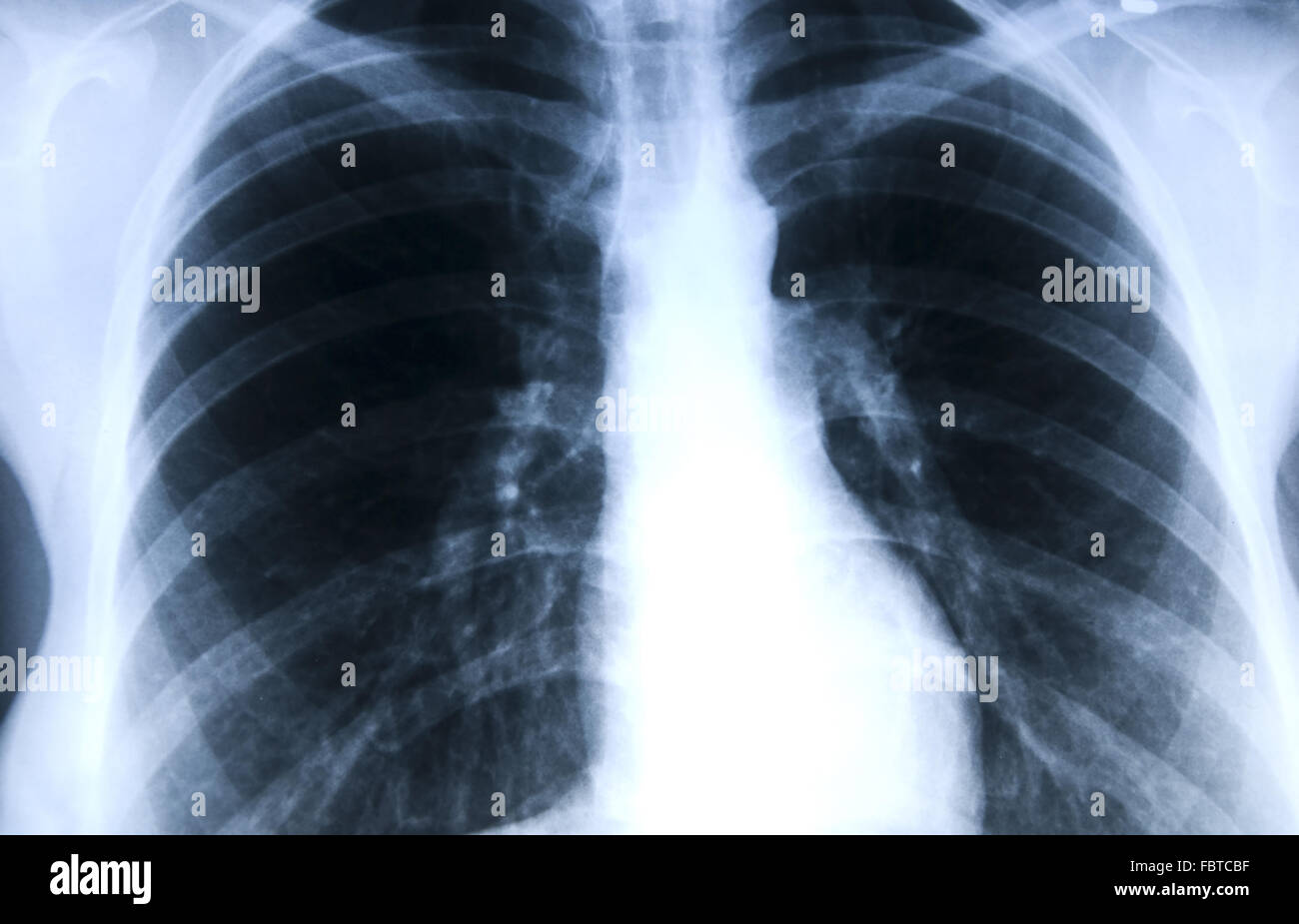 photo de rayons x Banque D'Images