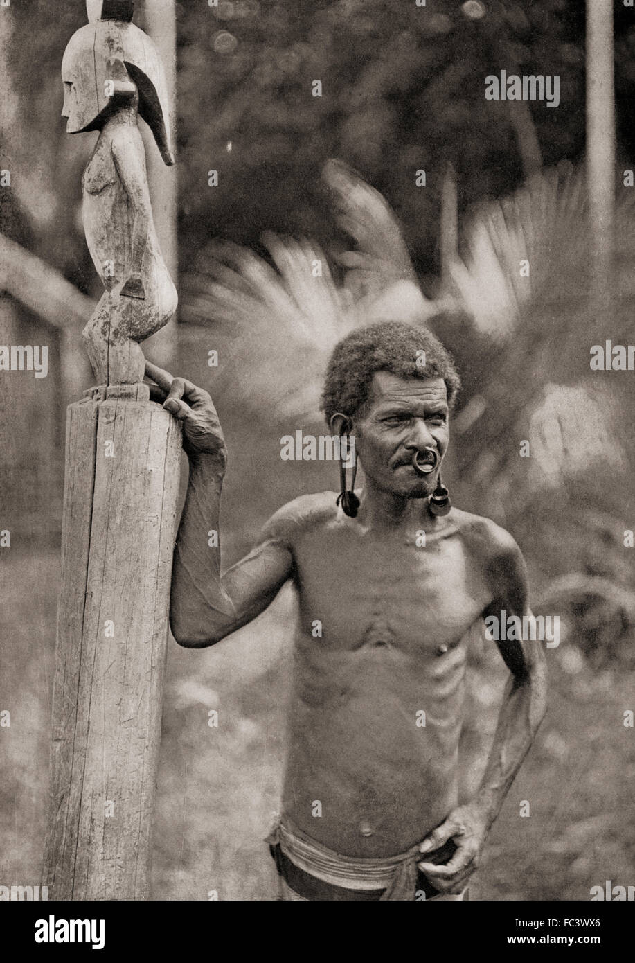 Malformation des oreilles. Un homme des Îles Salomon avec pierced oreille lobes qui sont agrandis par des disques, et portant un anneau dans le nez. Banque D'Images