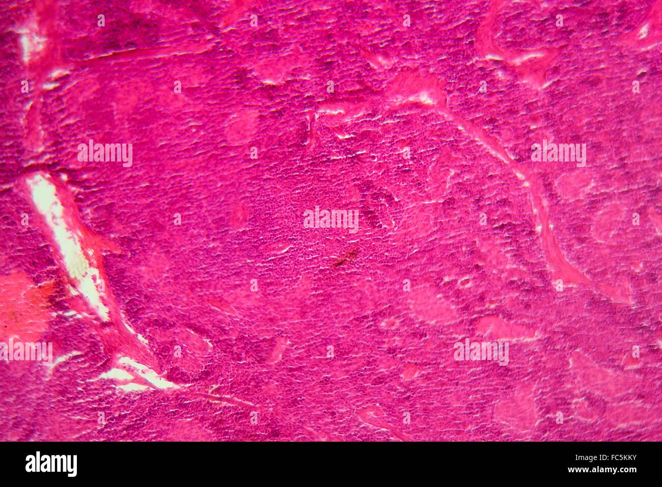 Des tissus du pancréas sous le microscope. Banque D'Images