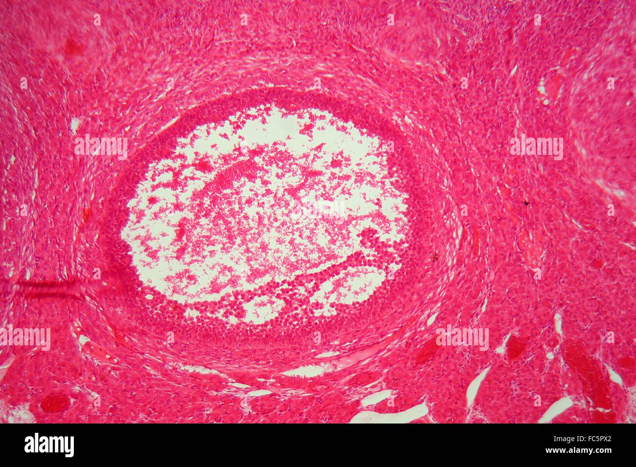 Les tissus de l'ovaire sous le microscope. Banque D'Images