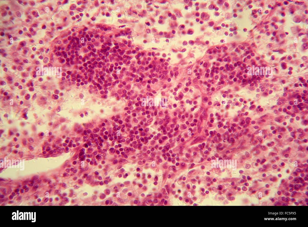 Nœud lymphatique sous le microscope. Banque D'Images