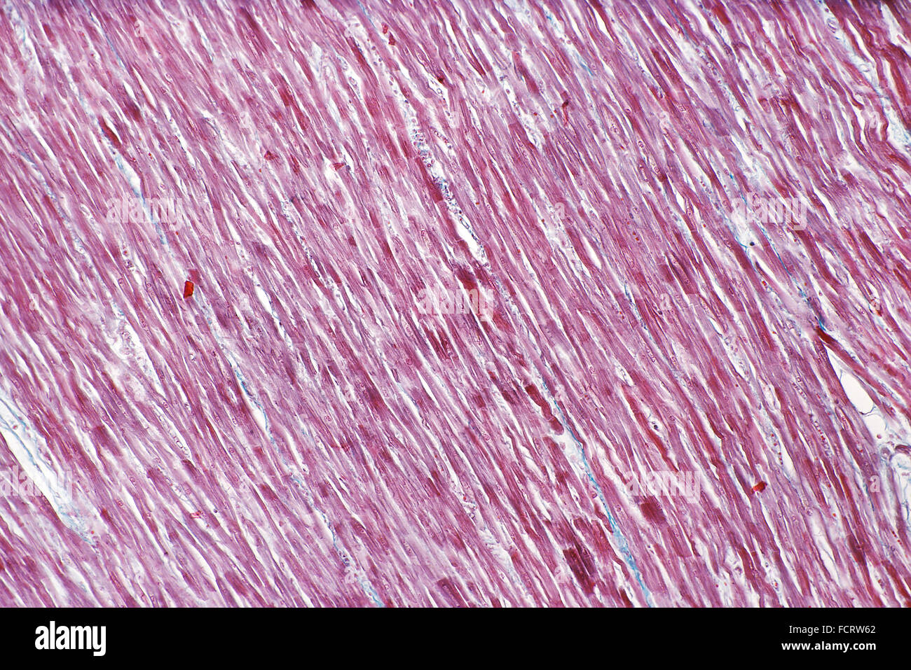 Le muscle cardiaque humaine Micrograph Banque D'Images