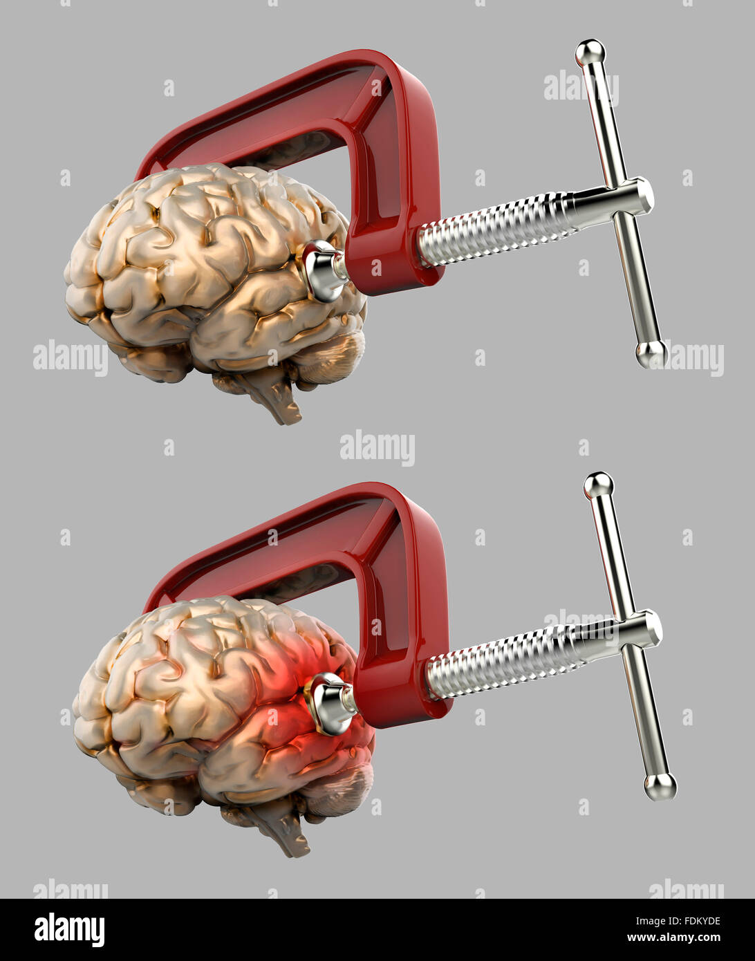 Maux de cerveau dans un collier isolé Banque D'Images