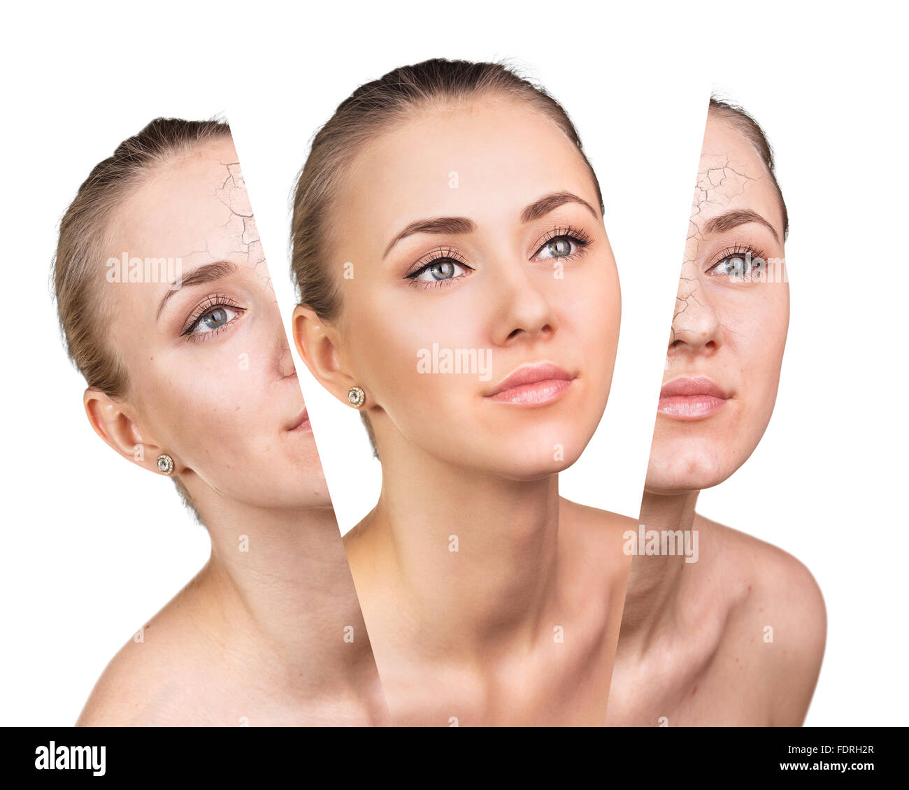 Concept beauté avant et après contraste. Banque D'Images