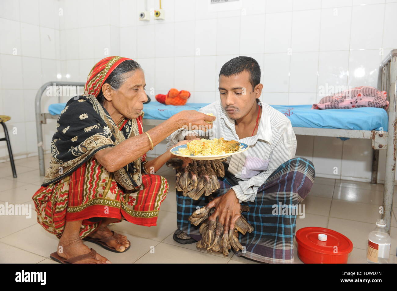 Dhaka, Bangladesh. 2 Février, 2016. Vajondar Abul, un patient atteint d'épidermodysplasie verruciforme, une rare maladie de peau, déjeune en prenant l'aide de sa mère en tant qu'il attend d'un traitement à la Dhaka Medical College Hospital à Dhaka, Bangladesh, 02 février 2016. Vajondar l'Abul a été souffrance écorce-comme des verrues sur les mains et les pieds depuis quatre ans. L'homme avec sa femme et une fille vivent dans le district sud de Khuna. Zakir Hossain Chowdhury Crédit : zakir/Alamy Live News Banque D'Images