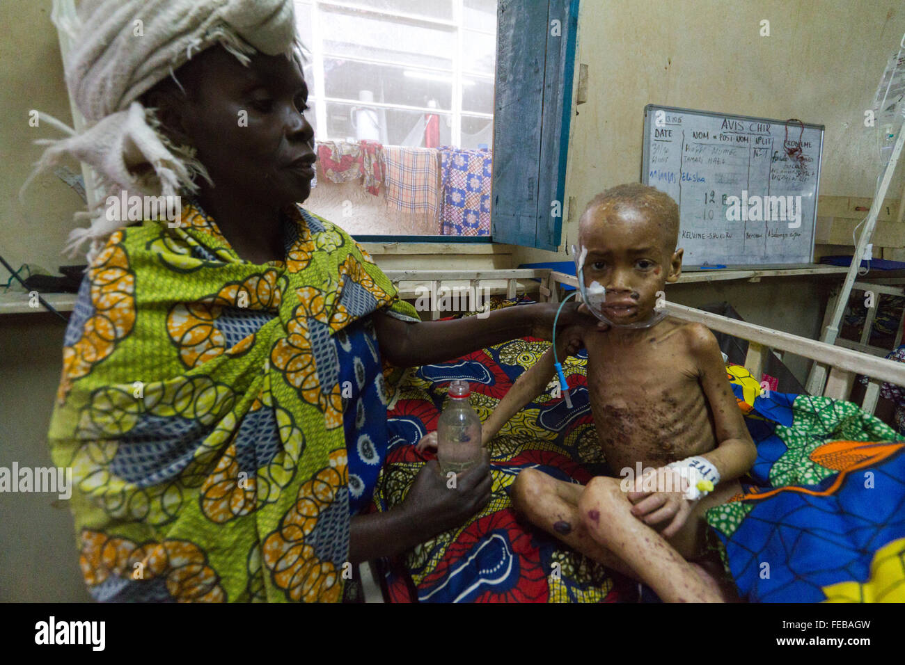 Les soins pédiatriques à l'hôpital MSF , Rutshuru, Nord Kivu, République démocratique du Congo, RDC, Afrique Banque D'Images Les soins pédiatriques à l'hôpital MSF , Rutshuru, Nord Kivu, République démocratique du Congo, RDC, Afrique Banque D'Images