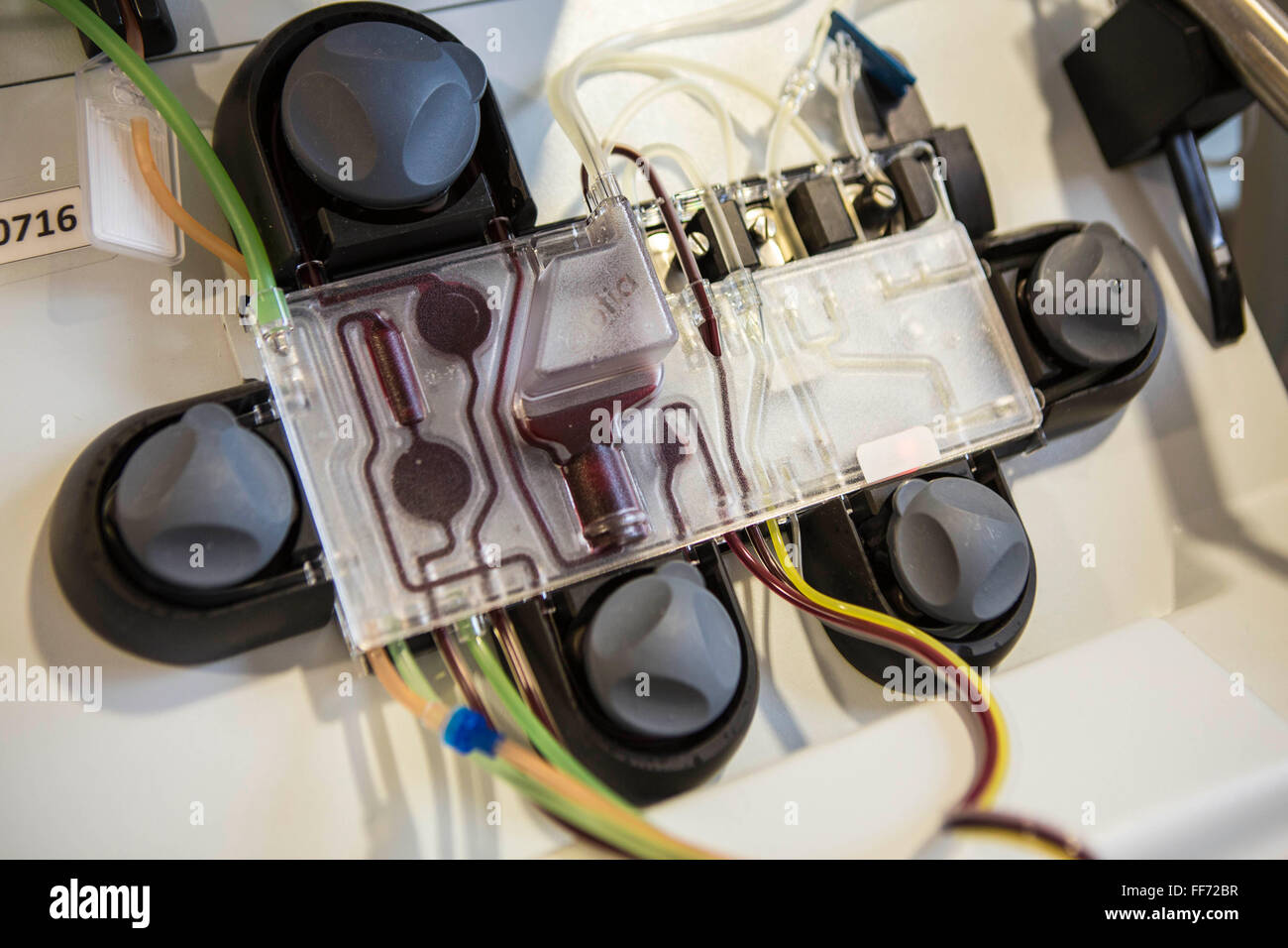 Matériel de transfusion médicale, appelée un séparateur de cellules, qui collecte le sang humain et le sépare de recueillir des cellules souches et renvoie le reste du sang pour le patient dans la clinique de Londres, Londres, Royaume-Uni. Les cellules souches hématopoïétiques seront ensuite utilisés comme une transplantation homologue pour une autre personne qui a le cancer du sang (leucémie). Banque D'Images